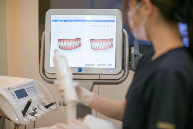 iteroによるシミュレーション