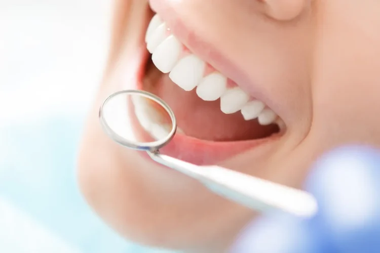 歯列矯正で歯が綺麗になったイメージ写真