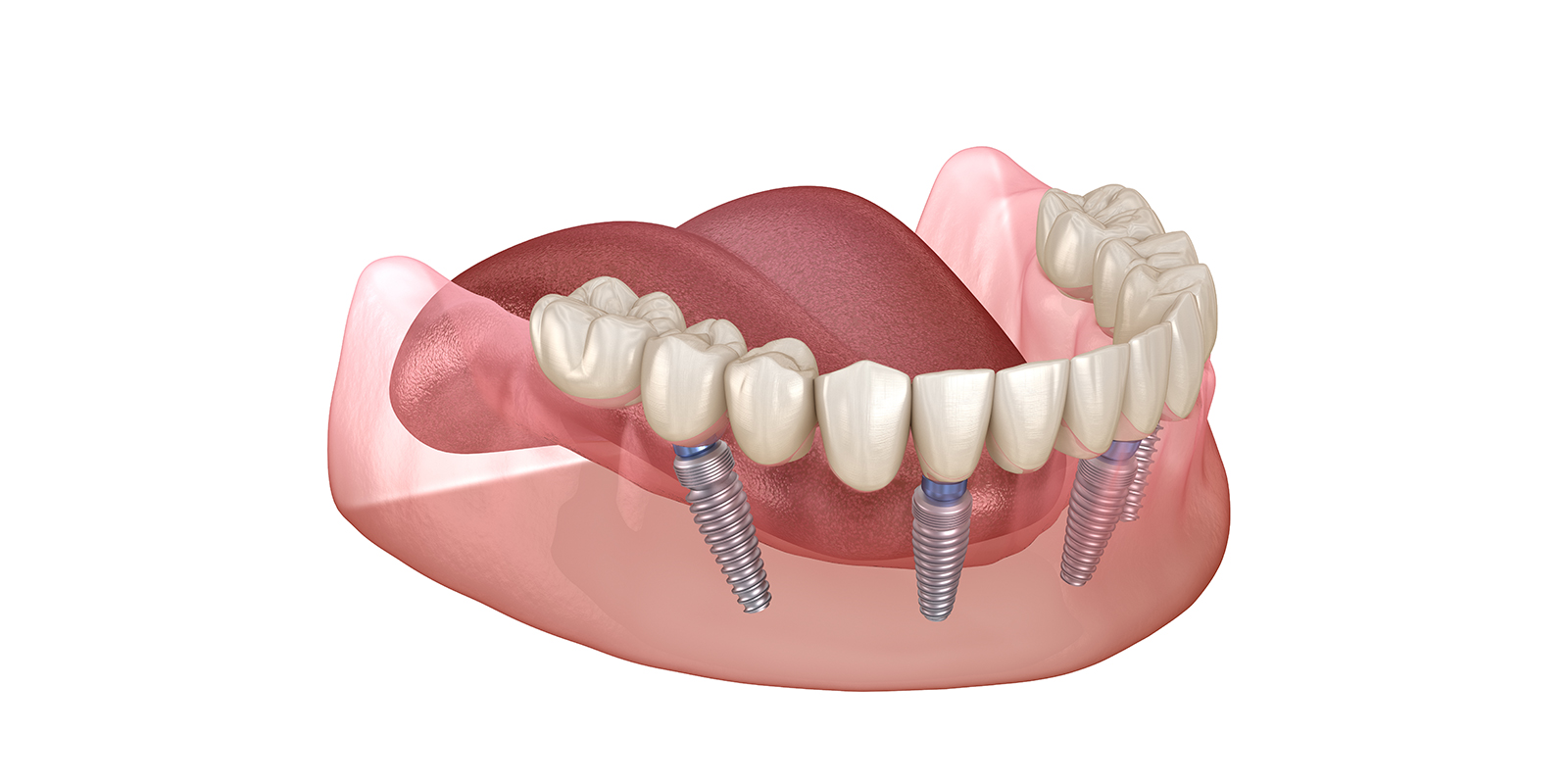 オールオン4のイメージ